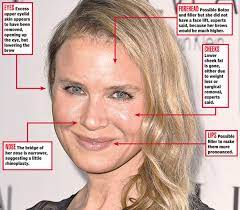 The official renee zellweger twitter page. Renee Zellweger S New Face Plastic Surgeons Tell Us What Work The Actress May Have Had Done New York Daily News