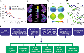 Figure 2 From Eeg And Erp Biomarkers Of Alzheimers Disease