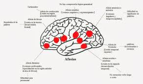 We did not find results for: La Afasia El Trastorno Que Hace Que Perdamos Nuestras Palabras Feel The Brain