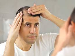cations that cause hair loss list