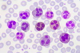 polymorphonuclear leukocytes white
