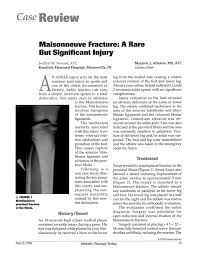 Maisonneuve fracture includes a wide range of injuries both to bone and ligamentous structures of the ankle. Maisonneuve Fracture A Rare But Significant Injury