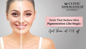 ls that reduce skin pigmentation