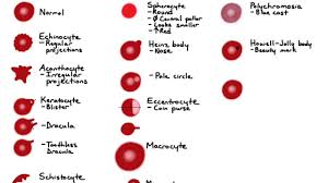Red Cell Morphology Smear Related Keywords Suggestions
