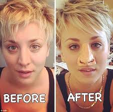 Check spelling or type a new query. Kaley Cuoco Jokes About Nose Job Rumors With Prosthetic In Big Reveal Photo Daily Mail Online