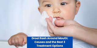 drool rash around mouth causes and the