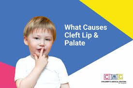 what causes cleft lip palate