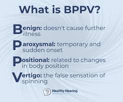 It typically occurs when you suddenly shift your head position. Bppv Positional Vertigo Causes Symptoms And Treatment