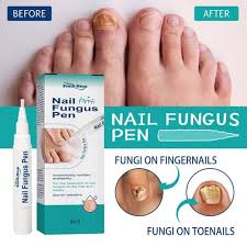 126 fungi nail commercial