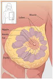 Extracapsular spread through blood vessels or through lymphatic system. What Is Breast Cancer Cdc