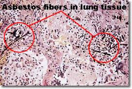 Asbestos Homeowner Information Health Effects Eh