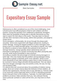 It's saying, hello reader, meet my character or exposition comprises of the choices you make, as a writer, to set the scene and initiate readers to. Expository Essay Samples Just The Facts By Sample Essay Medium