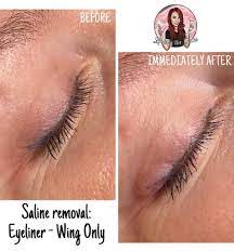 eyeliner tattoo removal how to remove