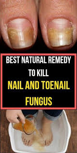 lime juice for toenail fungus a