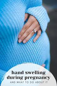 hand swelling during pregnancy