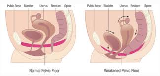 the pelvic floor kegel exercises