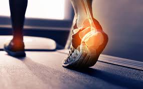 running injuries thigh and heel pain