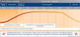 verlauf eines lippenherpes ausbruchs