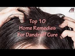 10 home remes for dandruff cure