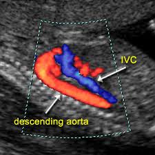Methodology Of Doppler Assessment Of The Placental Fetal