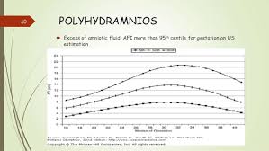 Polyhydramnios Chart Usdchfchart Com