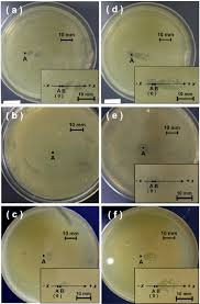 growth of e coli on lb agar plates