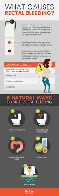 rectal bleeding causes 5 natural home