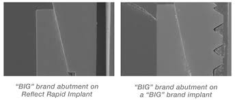 Reflect Dental Implant Systems Integrated Dental Systems
