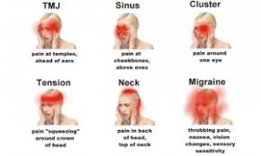 16 Location Of Pain Headache Location Headache Pain
