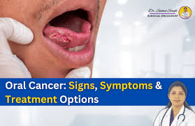 understanding cancer signs