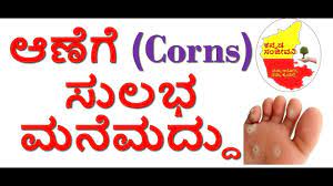 home remes for corns in kannada