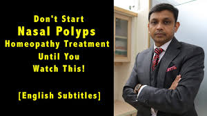 don t start nasal polyps homeopathy