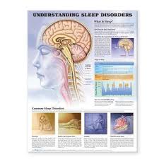 Understanding Sleep Disorders Anatomical Chart Anatomical