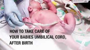 es umbilical cord after birth