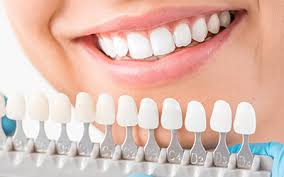 Cosmetic Dentistry Skokie Teeth Whitening Porcelain Veneers