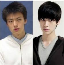 South korea has had the most cosmetics operations among its population compared to any and when you consider the role plastic surgeries play in the trans community or how they help people with physical deformities, i think it's pretty cool. Kpop Male Before And After Plastic Surgery Ezu Photo Mobile