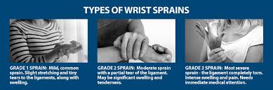 There are three grades for ankle sprains determined by the amount of force. Wrist Sprains Information Florida Orthopaedic Institute