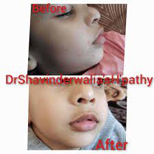 dr shavinder walia s homeopathic clinic