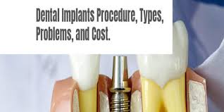 dental implant procedure types and