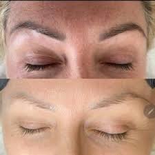 permanent makeup tattoo removal