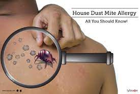 house dust mite allergy all you