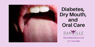 diabetes and dry mouth signs and