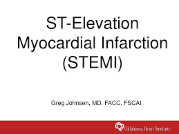 Ppt St Elevation Myocardial Infarction Stemi Powerpoint