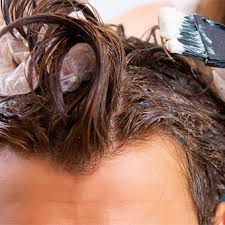 This will lessen and disappear completely over the next few days. Dying Your Hair After A Hair Transplant When And How