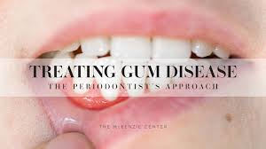 treating gum disease the mckenzie