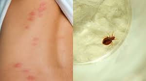 Paris Bed Bug Infestation How To Tell