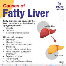 fatty liver symptoms grade causes