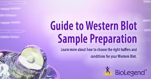 guide to western blot sle preparation