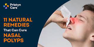 11 natural remes that can cure nasal