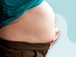 what is a b belly during pregnancy and